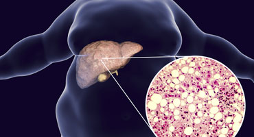 best nutritionist for liver